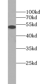      anti- P53 antibody