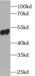      anti- P53 antibody