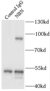 NBN抗体