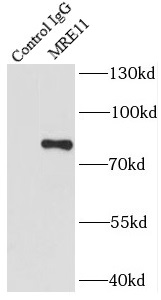      anti- MRE11 antibody