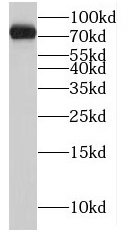      anti- MRE11 antibody