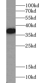      anti- RAD51 antibody