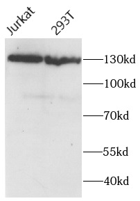      anti- PALB2 antibody