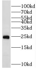      anti- RAB2 antibody