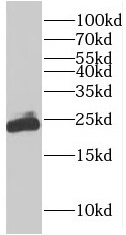      anti- RAB9A antibody