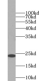      anti- RAB5A antibody