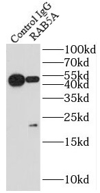      anti- RAB5A antibody