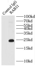 anti- RAB11 antibody