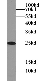 anti- RAB11 antibody