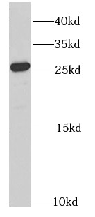      anti- RAB27A antibody