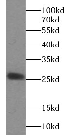      anti- RAB27A antibody