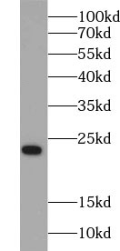      anti- RAB8A antibody