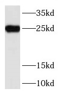      anti- RAB3A antibody