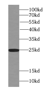      anti- RAB3A-specific antibody