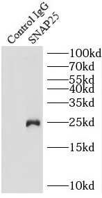 SNAP25抗体