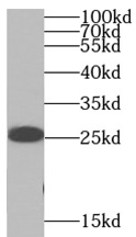      anti- SNAP25 antibody