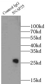 SNAP25抗体