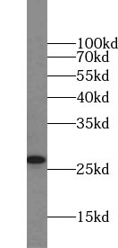      anti- SNAP25 antibody