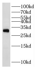      anti- RPL7A antibody