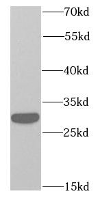      anti- RPS3 antibody