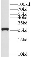      anti- RPS3 antibody