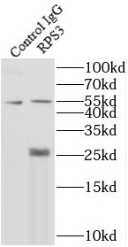 RPS3抗体