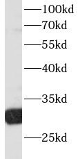      anti- RPS3 antibody