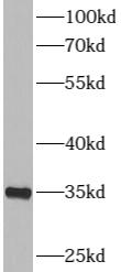      anti- RPS6 antibody