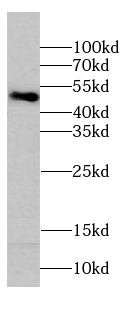      anti- ribosomal protein L4 antibody