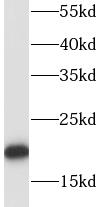      anti- RPL18A antibody