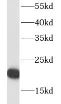      anti- RPL18A antibody