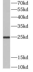      anti- CD9 antibody