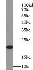      anti- CD81 antibody