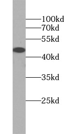      anti- TSG101 antibody