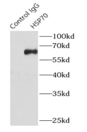      anti- HSP70 antibody