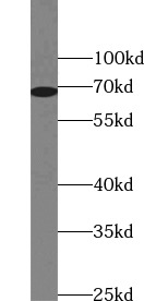      anti- HSP70 antibody