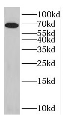      anti- HSP70 antibody