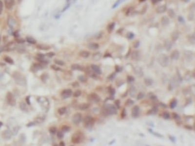 HSP70抗体