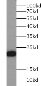      anti- GM-CSF antibody