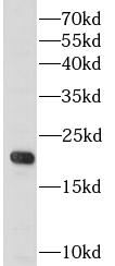      anti- G-CSF antibody