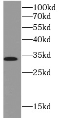     anti- EPO antibody