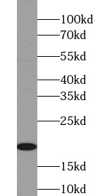      anti- LIF antibody