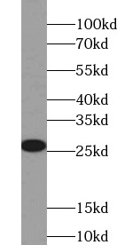 anti- RAB4A antibody