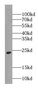   anti- RAB5A-Specific antibody