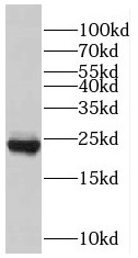  anti- RAB7A antibody