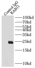 RAB11特异性抗体