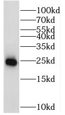      anti- RAB11-Specific antibody