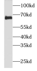      anti- NF-L antibody