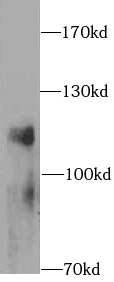 anti- LAMP1 antibody