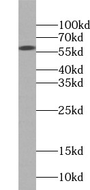     anti- PDI antibody